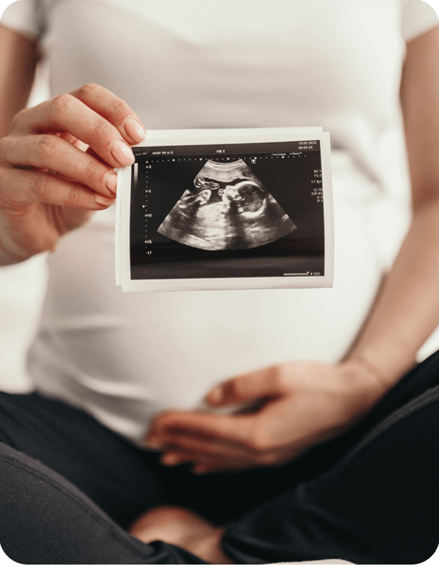 pregnant women with ultrasound rounded edges